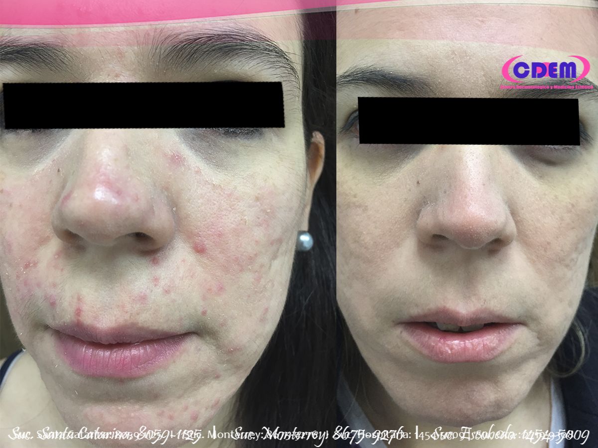 Mercedes Fernández Reyes-18