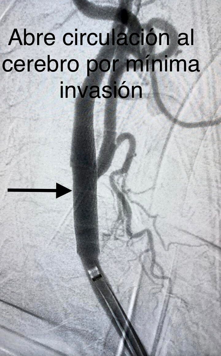 Miguel Abraham Lara Perez-11