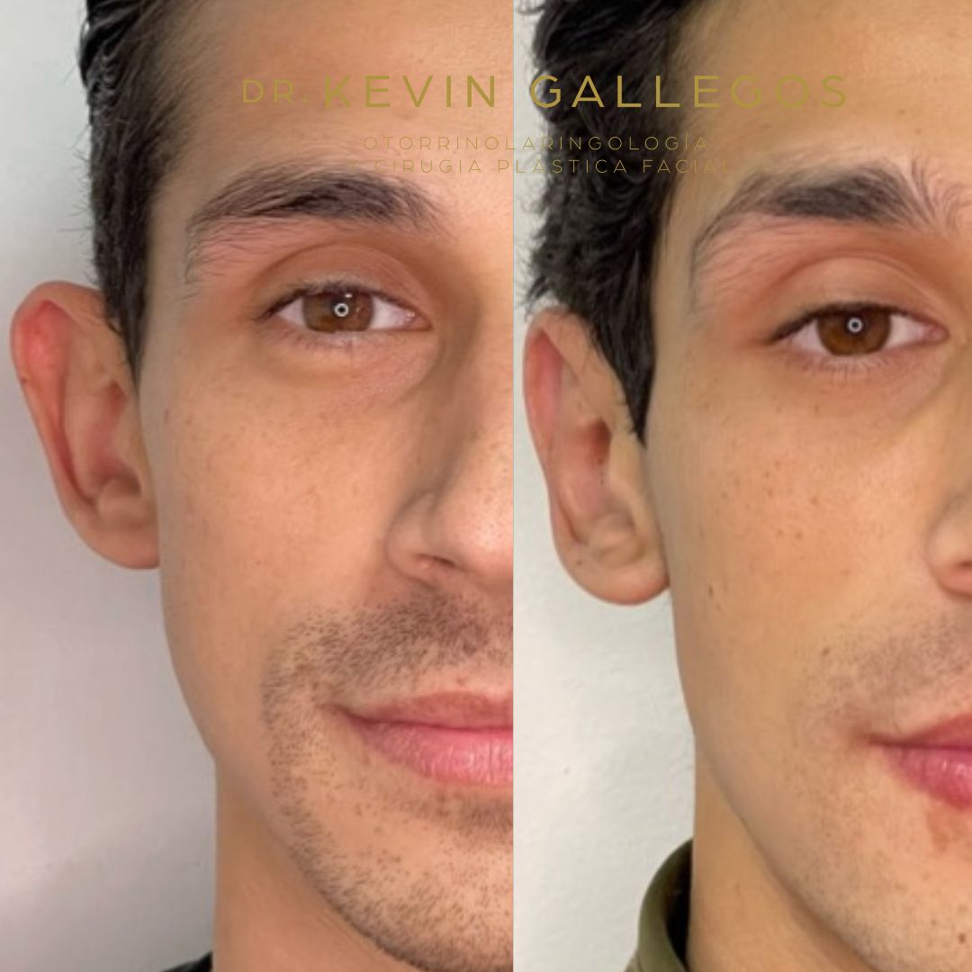 Kevin Iram Gallegos Montero-4