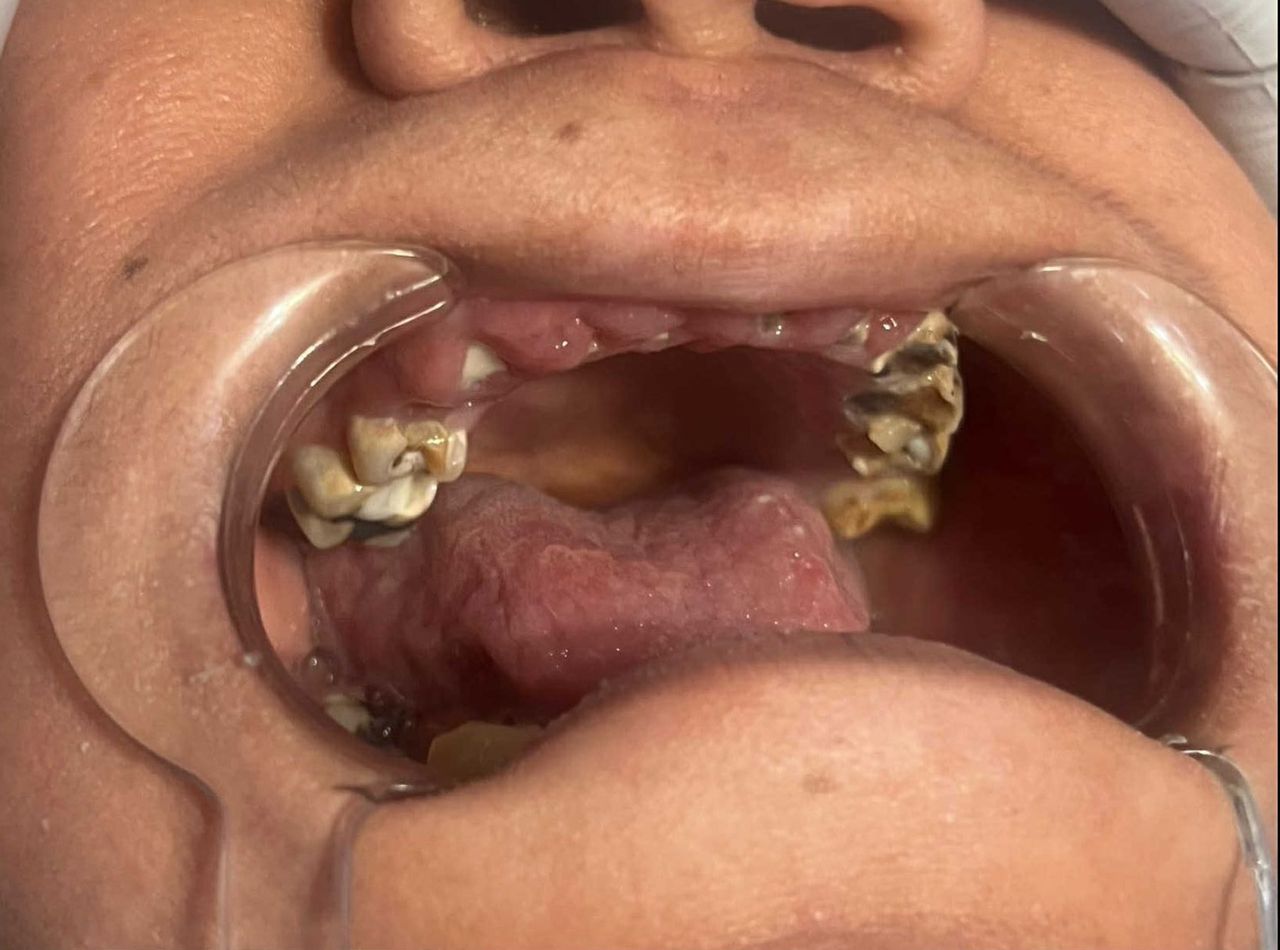 Alfredo Meléndez Rodríguez-7