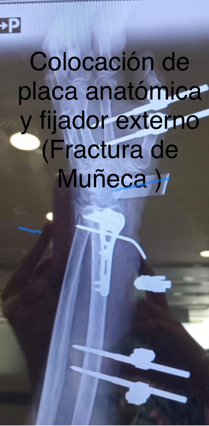 Emmanuel Bolaños Cortes-16