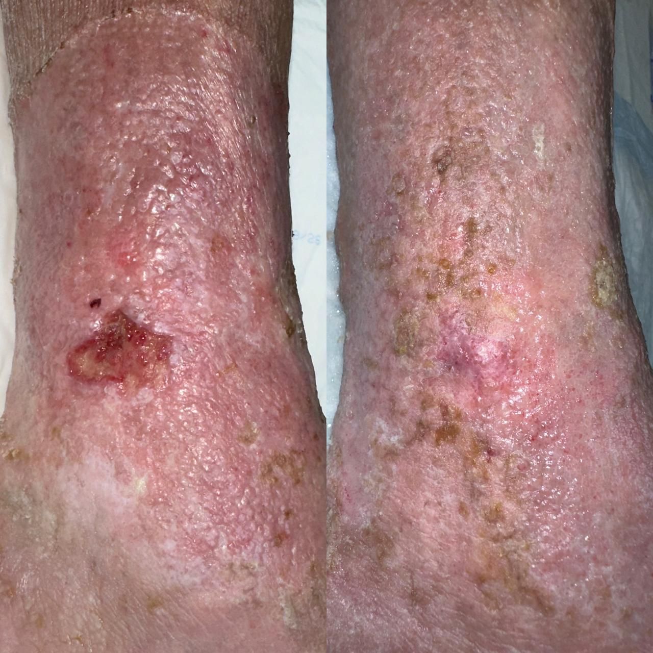 Jhonatan López González-26