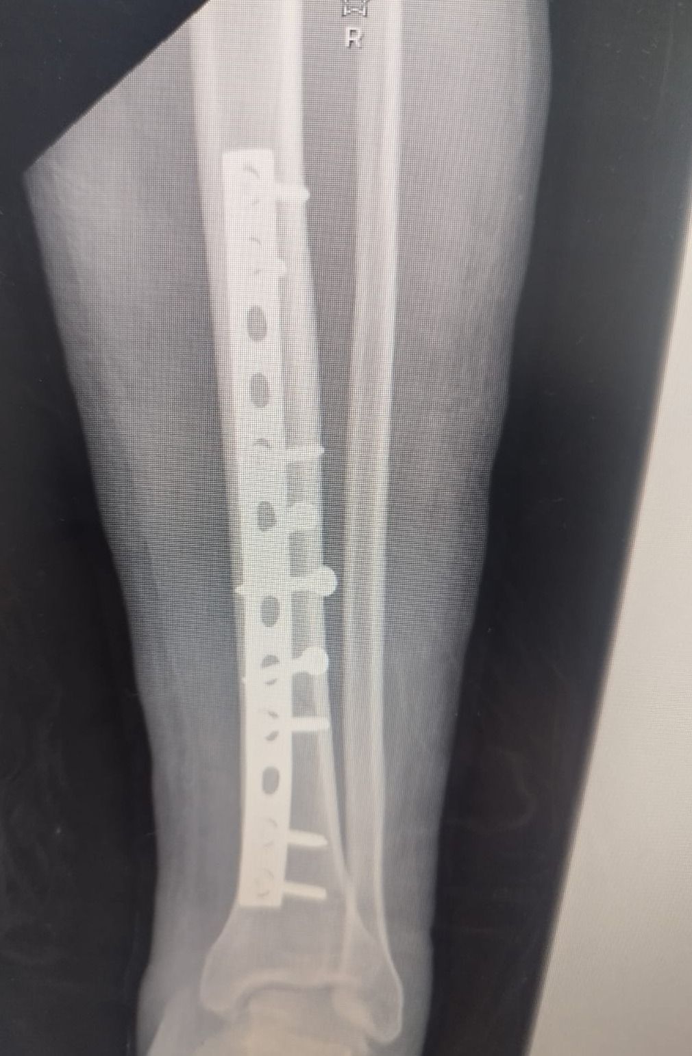 Leonardo Isaac Re-10