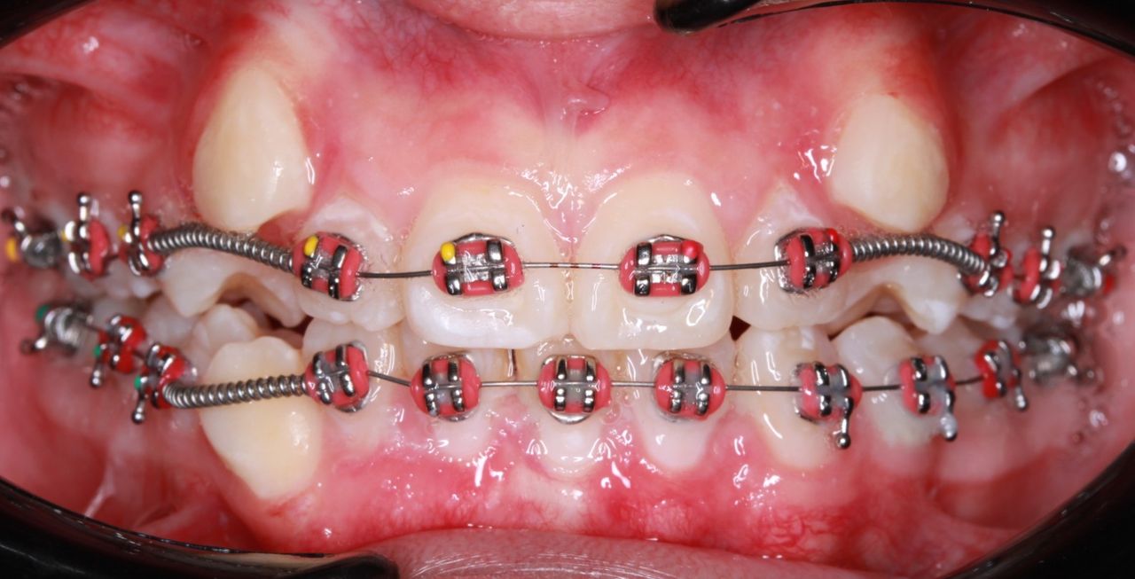 César Osvaldo Poot Chan-12