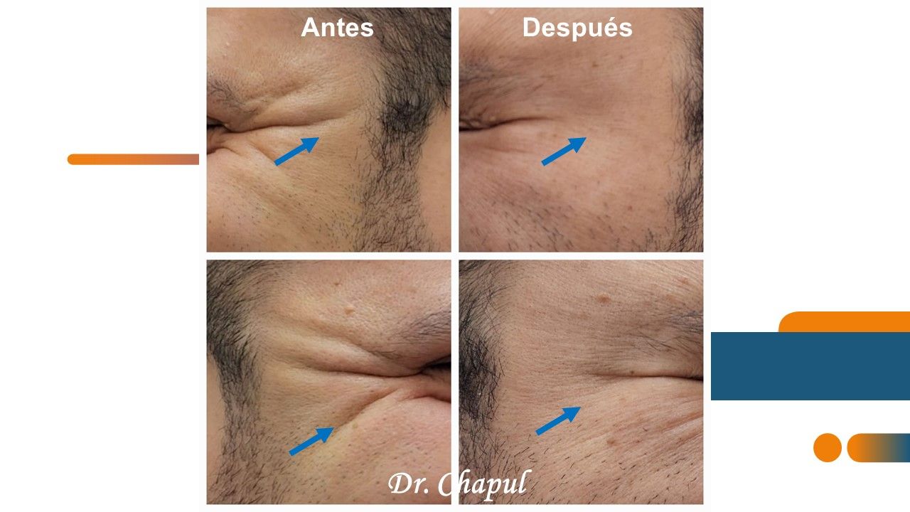 José Luis Muñoz Chapul-32