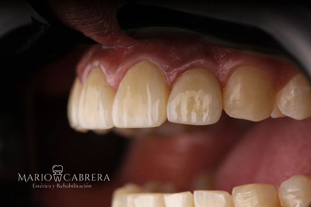 Mario Francisco Cabrera Ballona-3