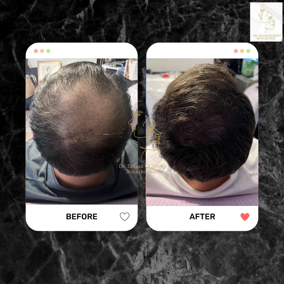 Edgar Octavio Rosales Diaz-8