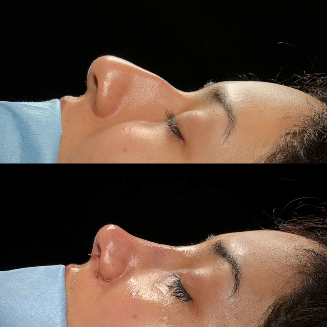 Angel Castro Urquizo-93