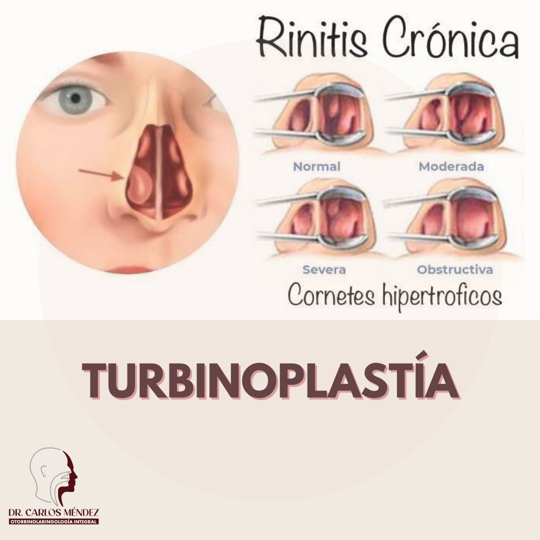 Juan Carlos Mendez Gutierrez-26