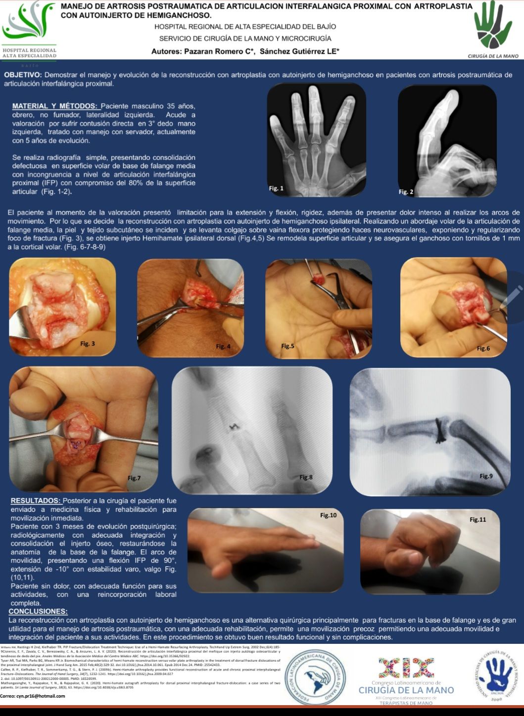 Cynthia Pazaran Romero-6