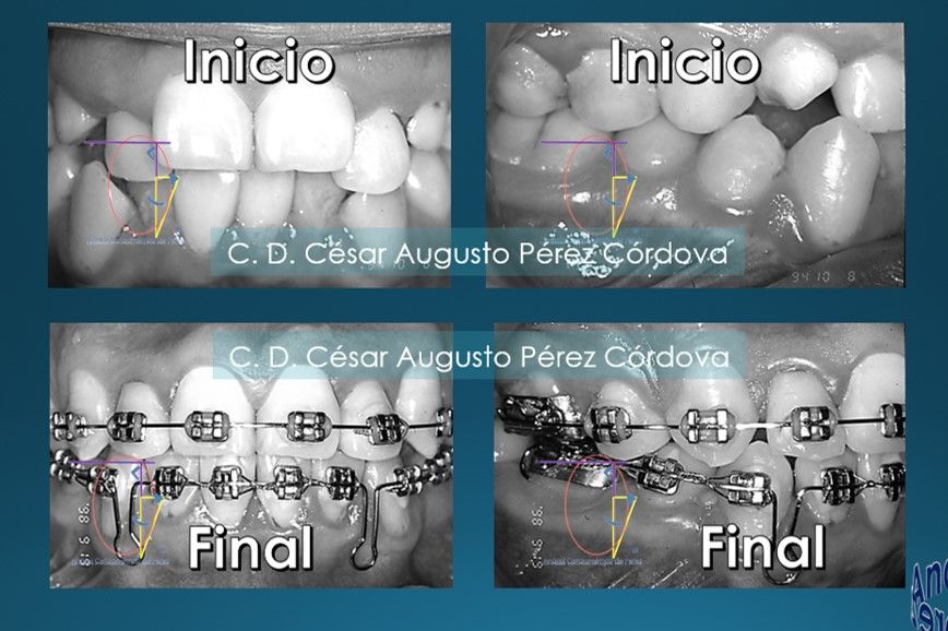 César Augusto Pérez Córdova-26