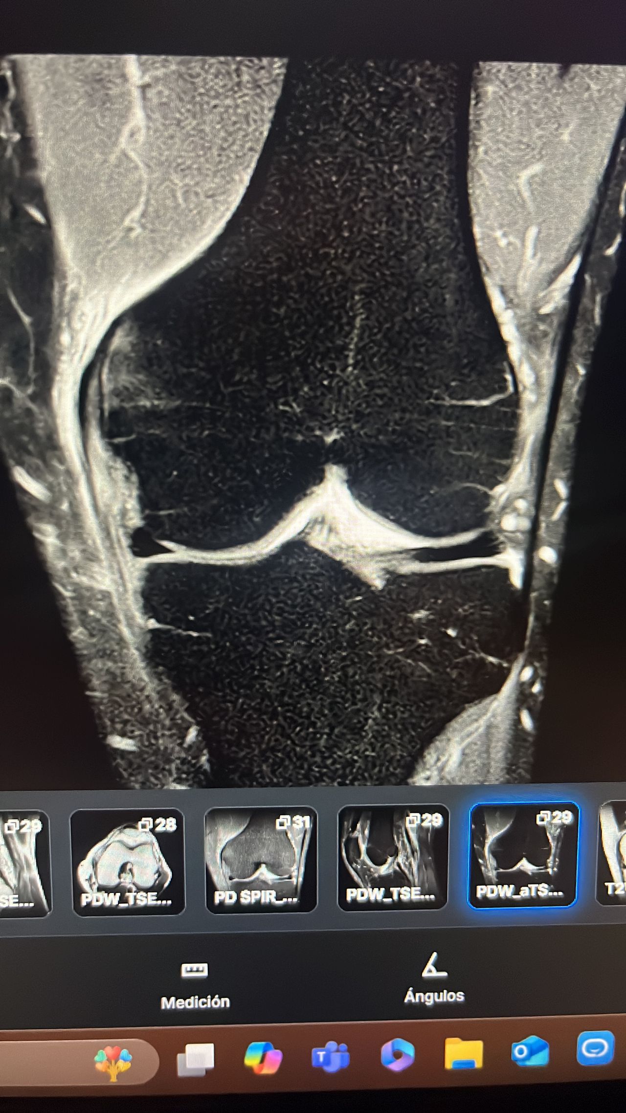 Manuel Alejandro Villagrán Luján-11