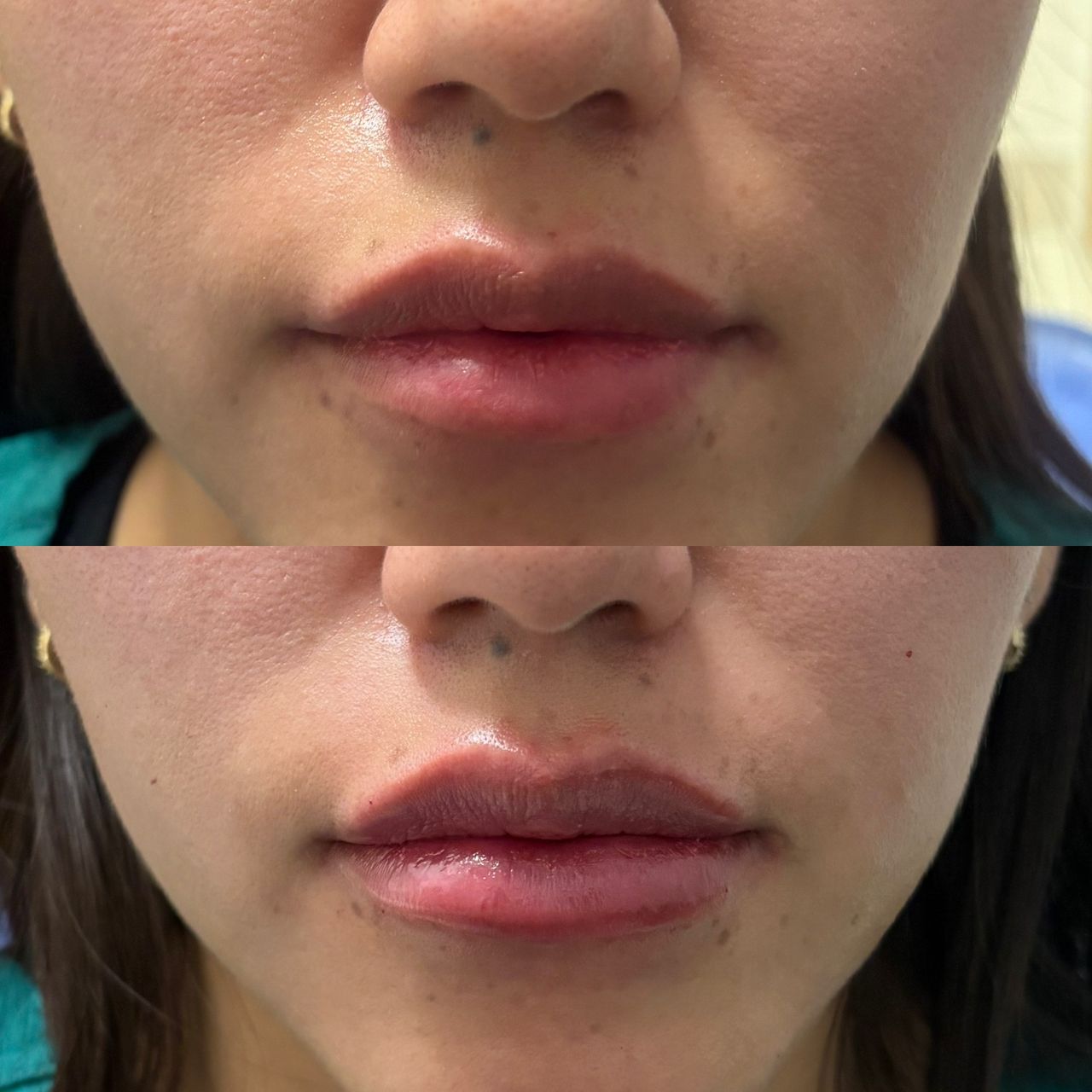 Venecia Landini Enríquez-10