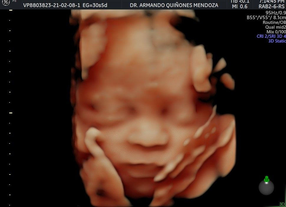 Armando Quiñones Mendoza-15