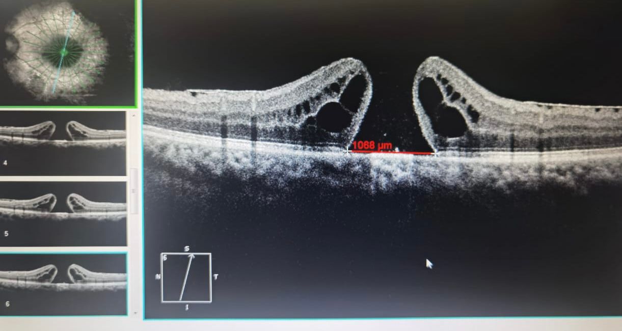 Javier Suárez Arguello-0