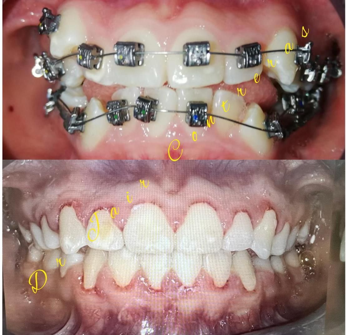 Jair Contreras García-16