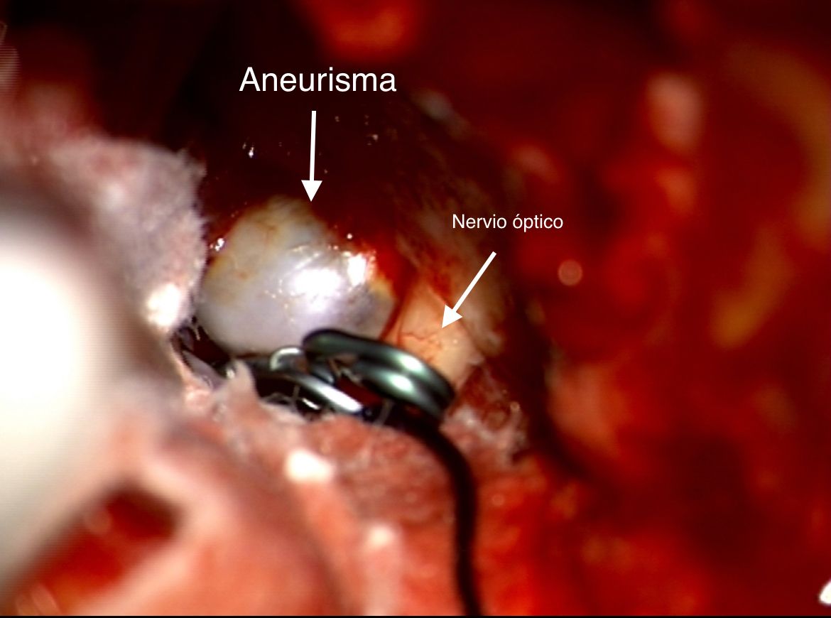 Celia Teresa De Jesús Álvarez Gamiño-29