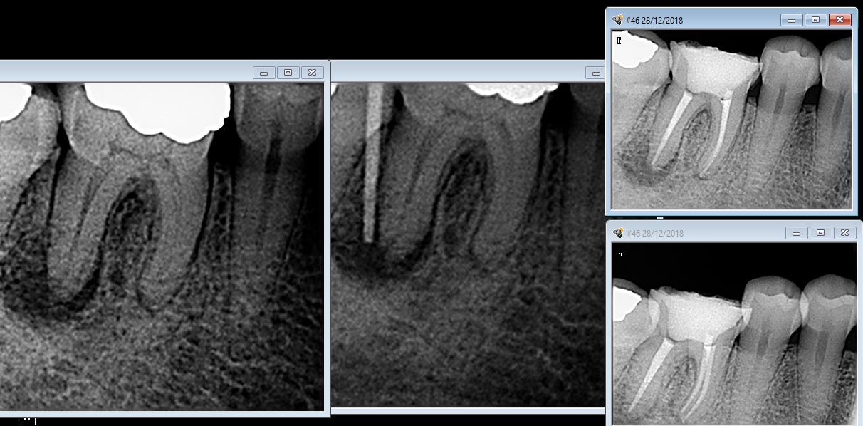 Lesli Erendira Campechano Zaragoza-18