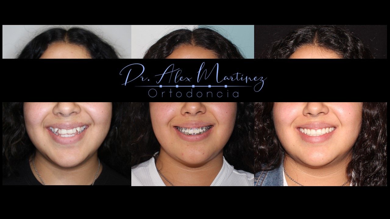 Alejandro Martínez Hernández-5