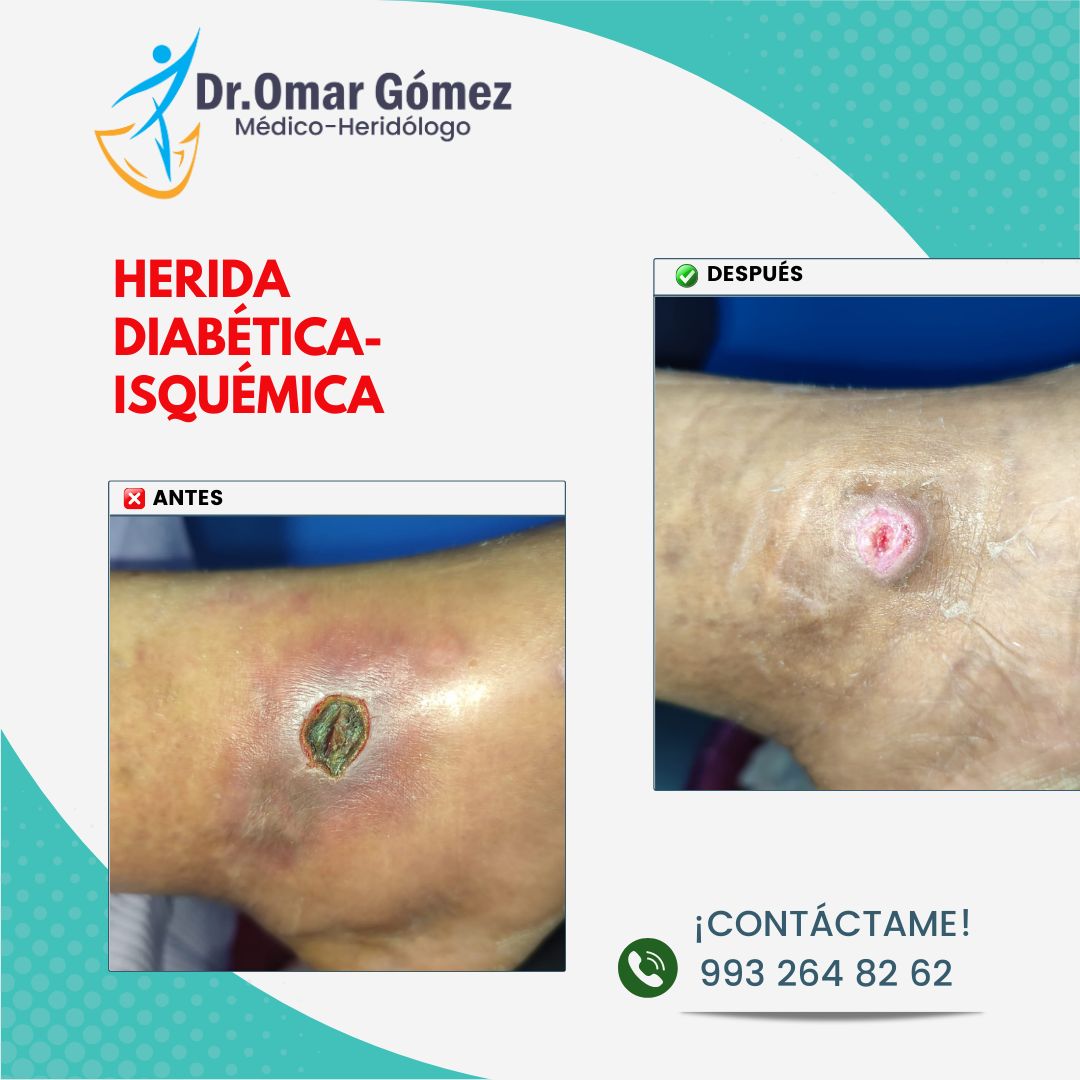 Omar Gómez López-4