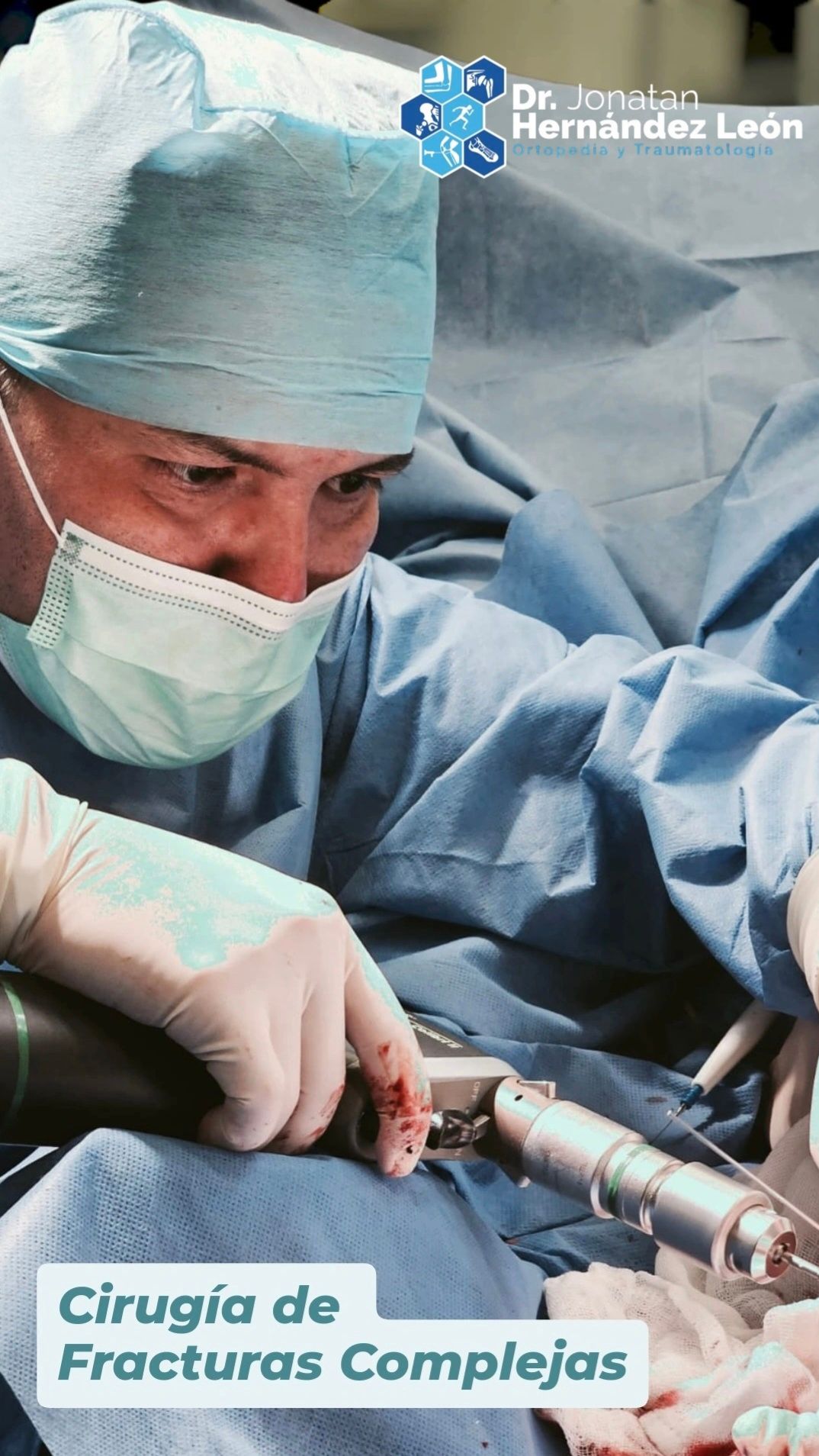 Jonatan Hernández León-33