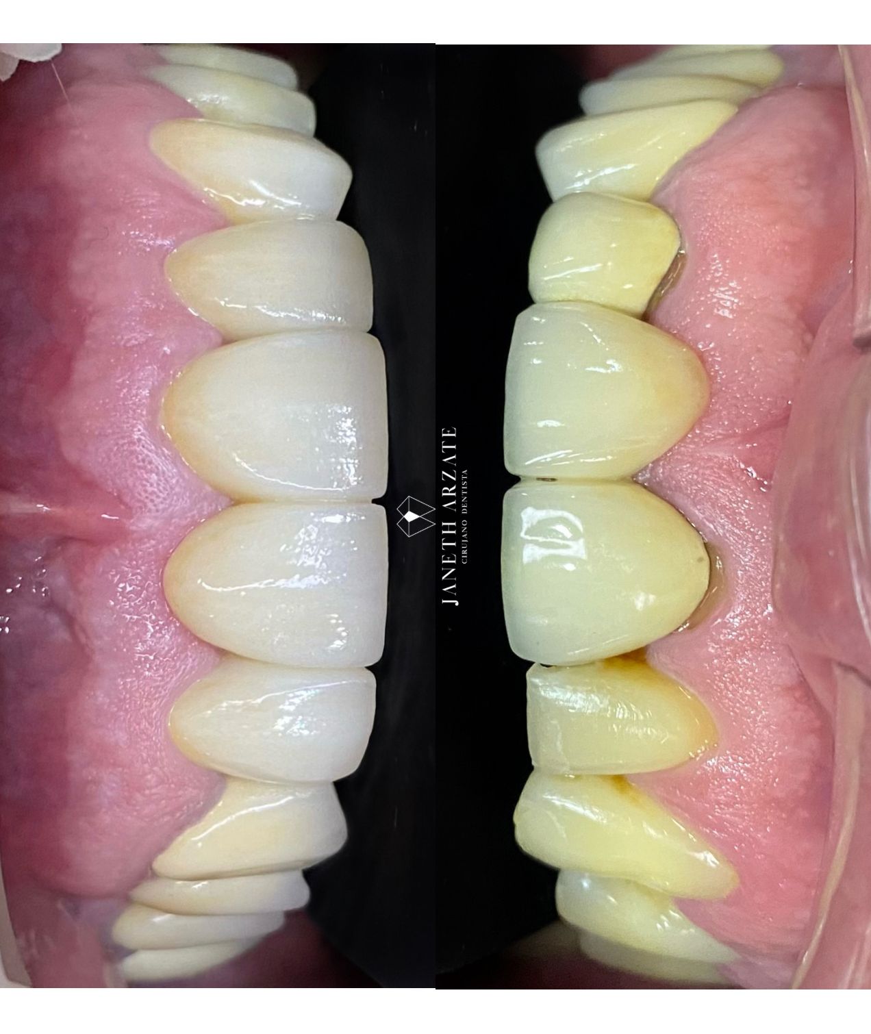 Janeth Arzate Banda-11