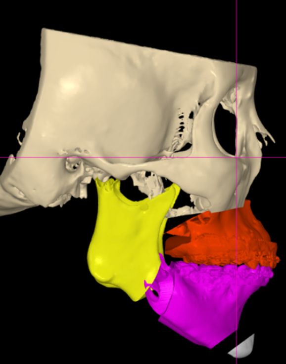 Luis Enrique Cruz Hernández-42