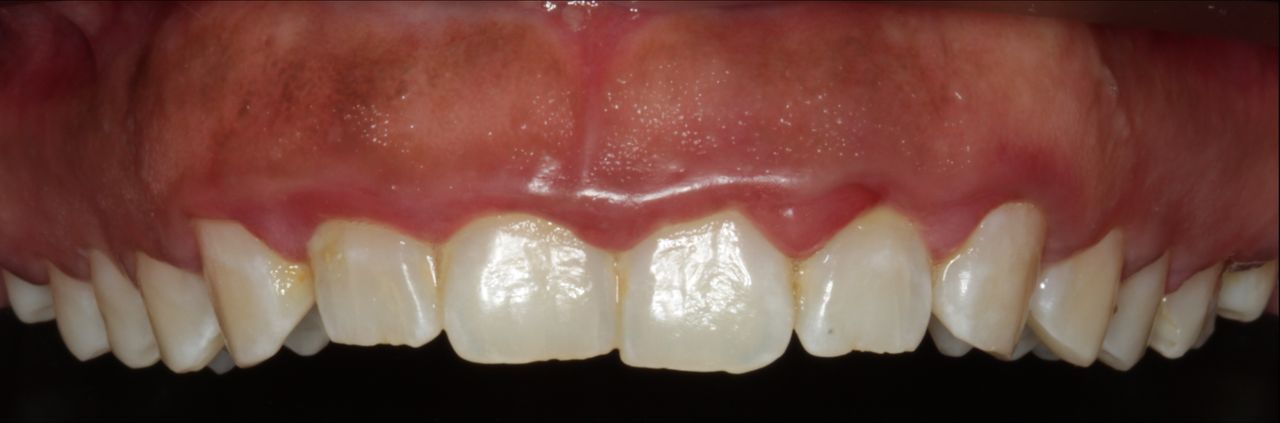 Agustin Salamanca Tapia-3