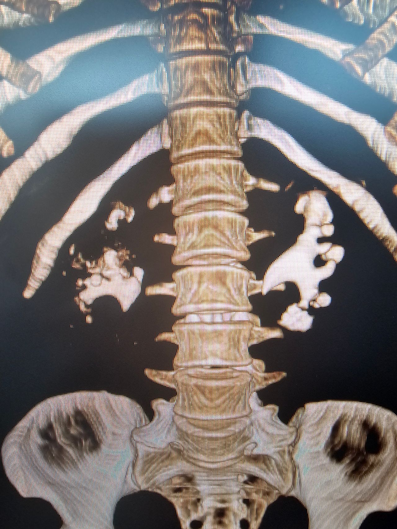 Efrain Barradas Huervo-28