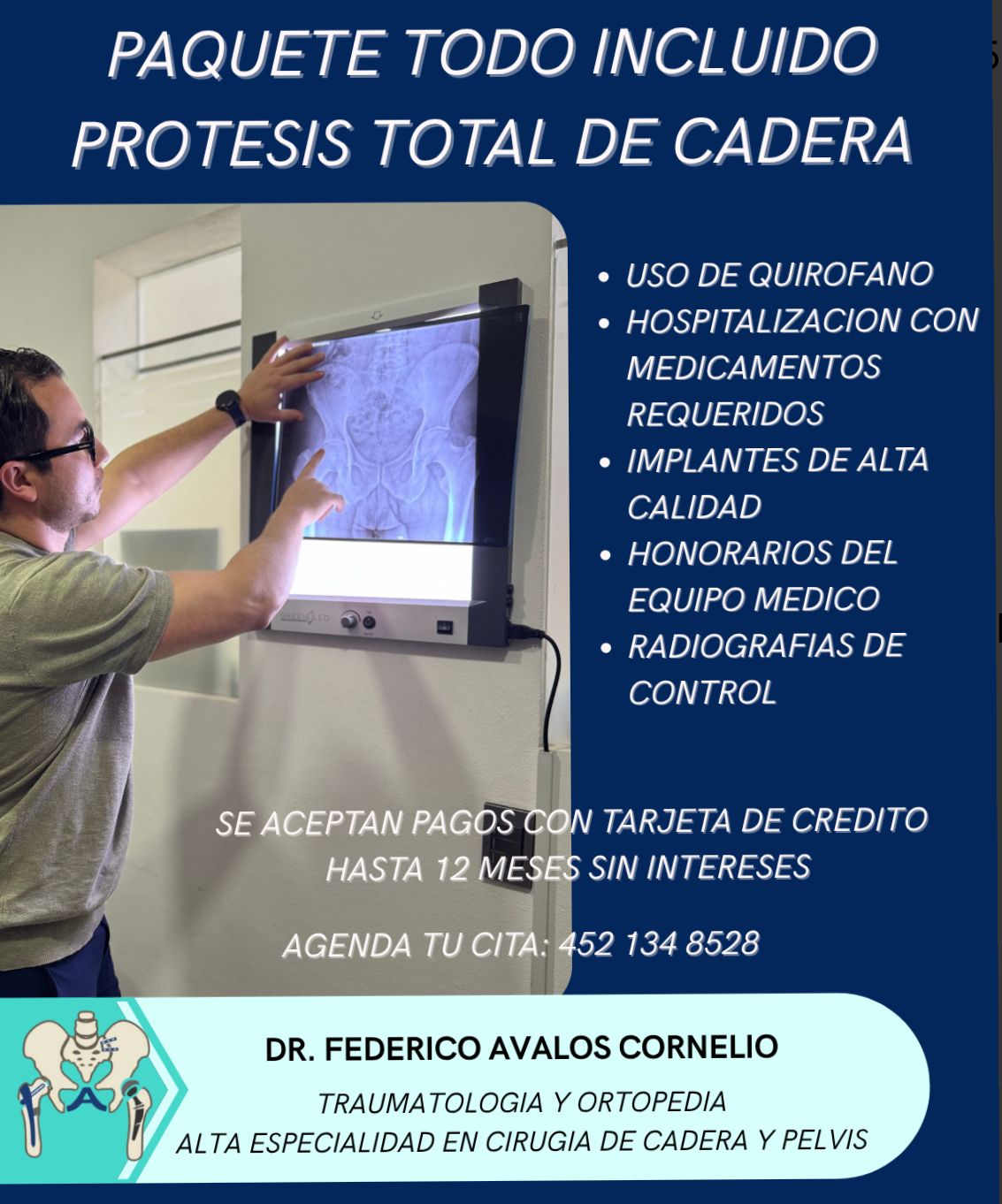 Federico Avalos Cornelio-4