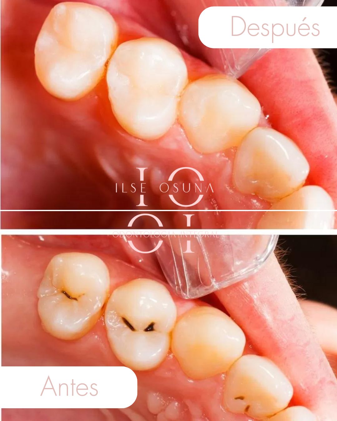 Ilse Valeria Osuna Rodríguez-16