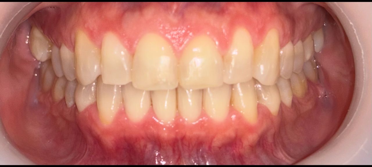 Priscila Berenice Gutiérrez Martínez-3