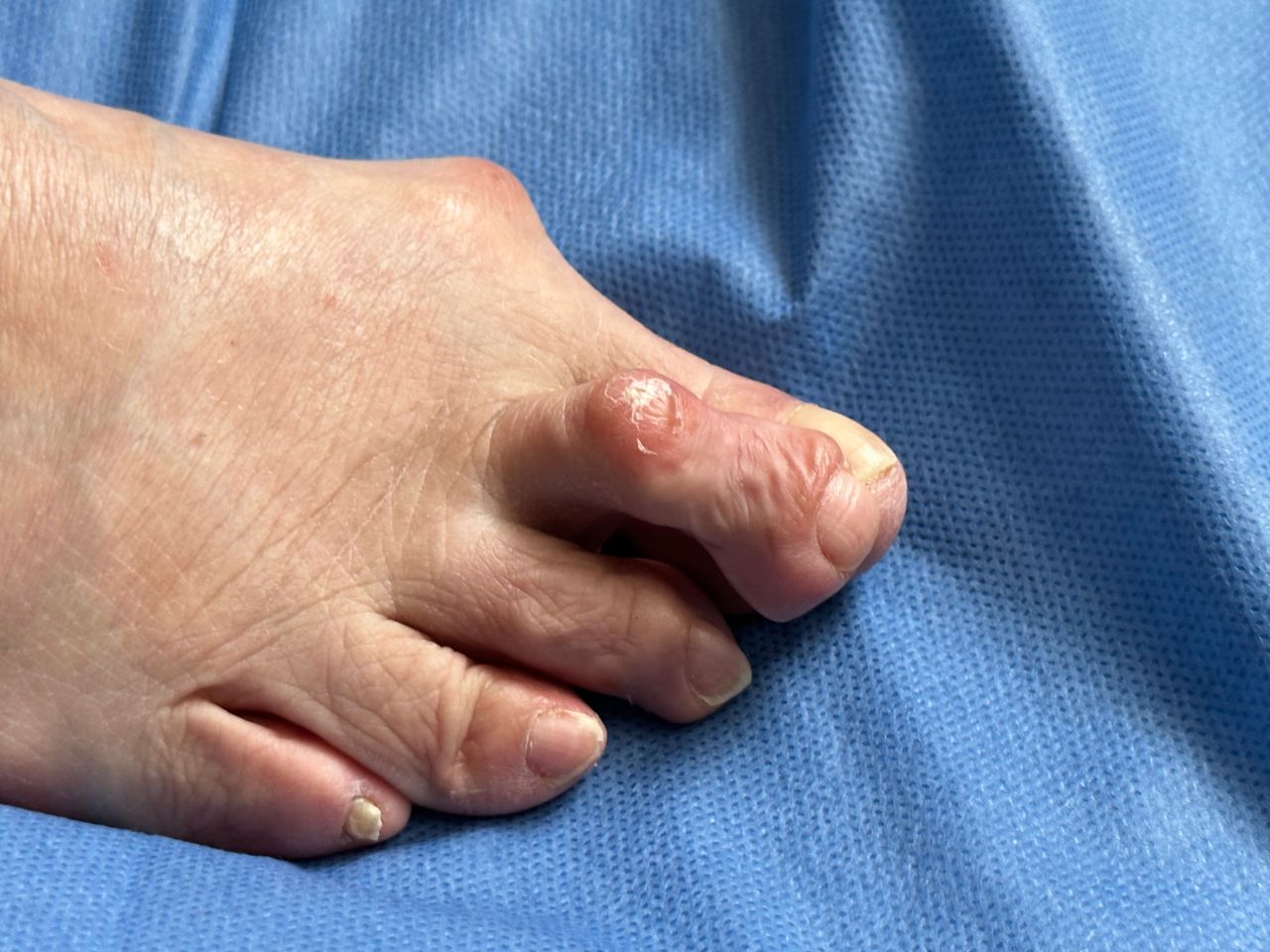 Carlos Ignacio Muñoz Valadez-3