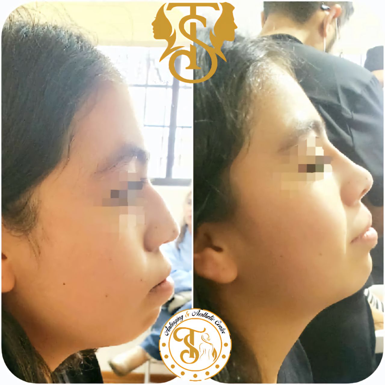 Samuel Torres Torres-10