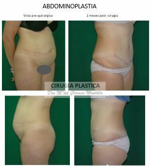 María Del Carmen Montilla Muñoz-2