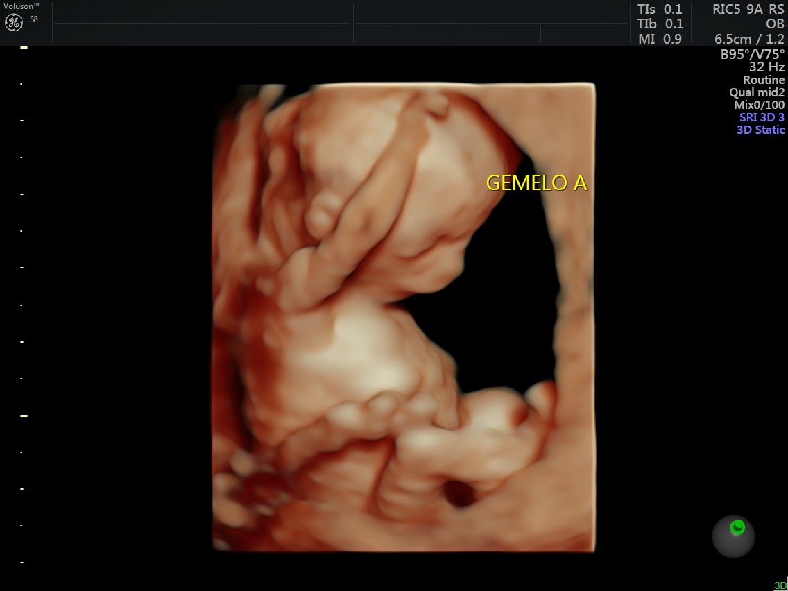 Griselda Reyes Torres-14