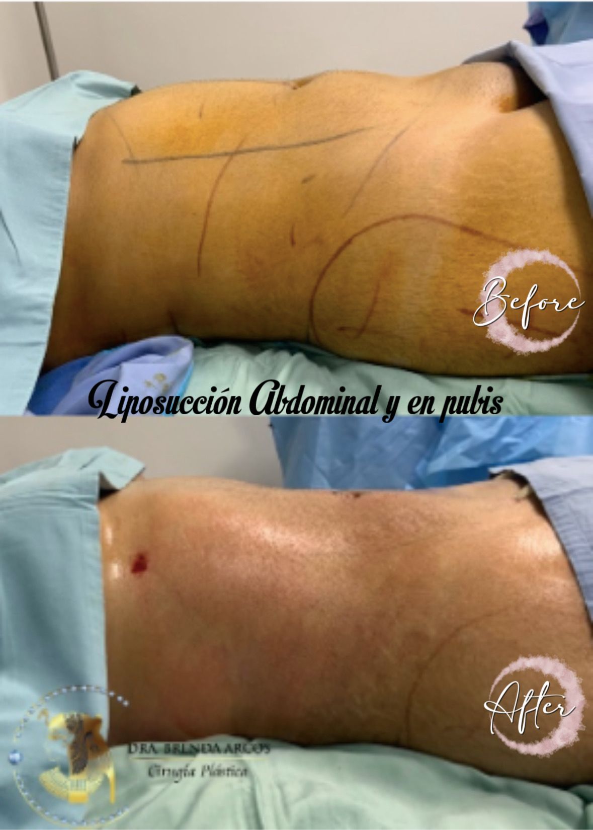 Brenda Arcos Vera-45