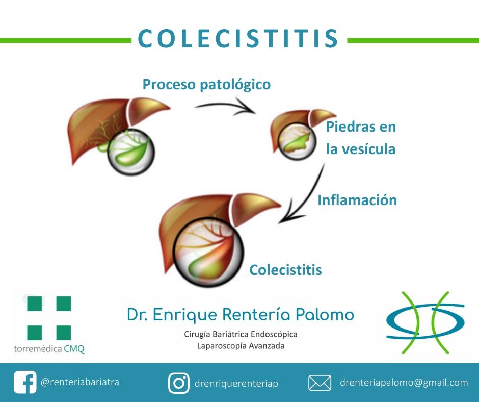 Enrique Rentería Palomo-42