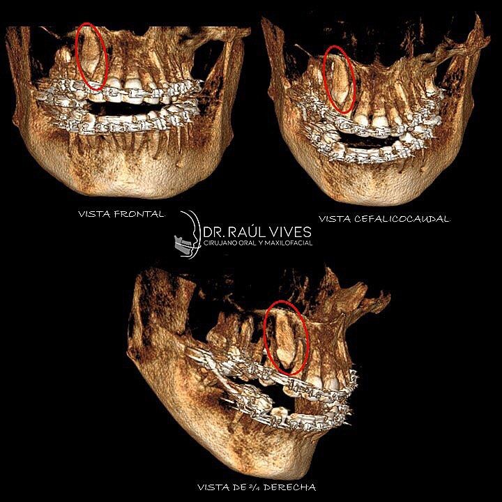 Raúl José Vives Serrano-11