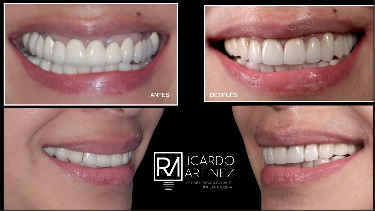 J. Ricardo Martínez-14