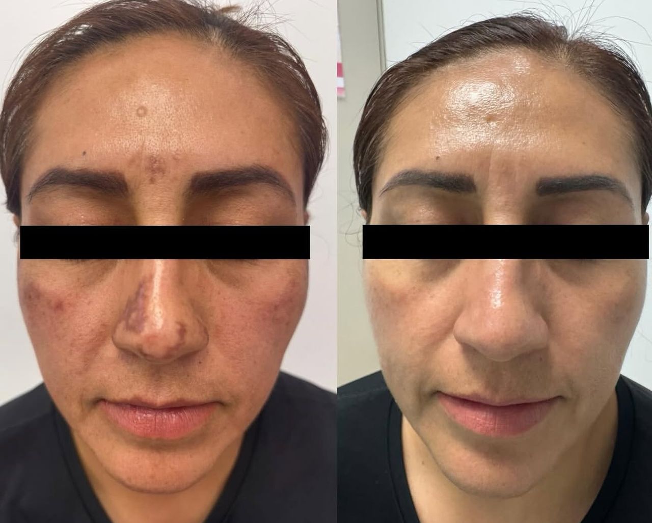 Daniela Tonanzin Guzmán Colín-1