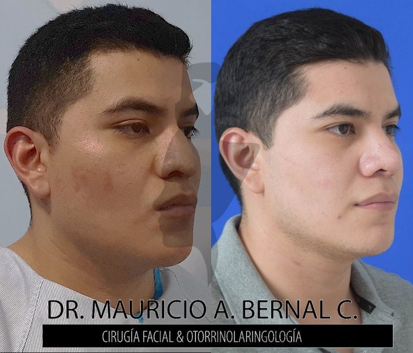 Mauricio Alejandro Bernal Carreon-25