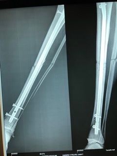 Josmar Adrián Lopez Eng-8