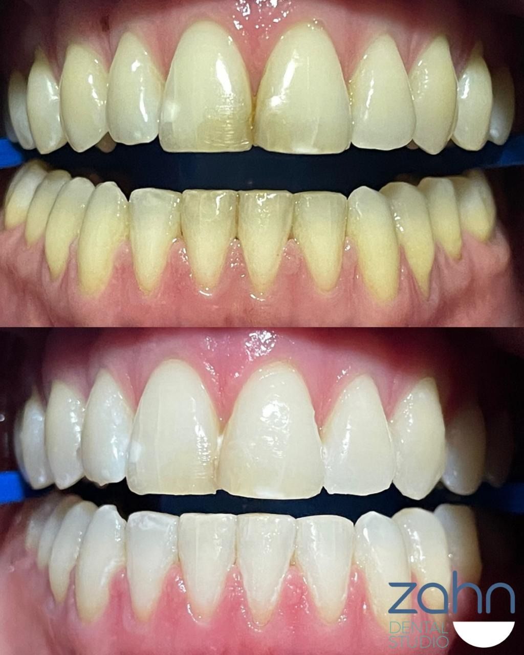 Yury Joven Salcedo-0