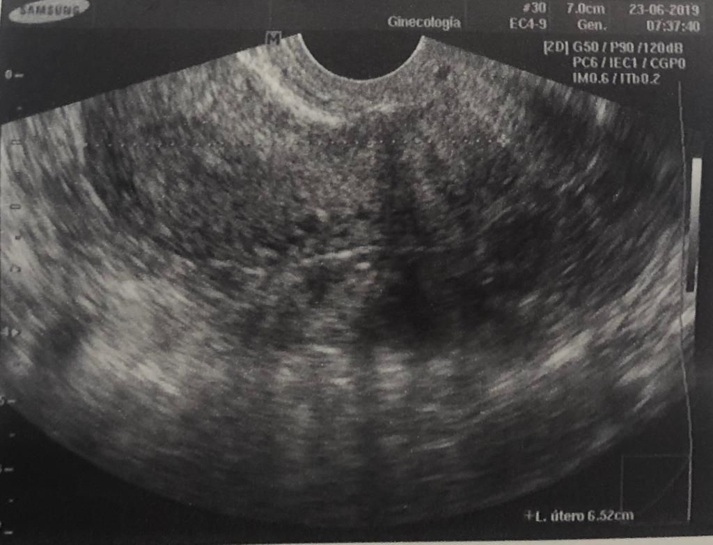 Imelda Zárate Fierro-9