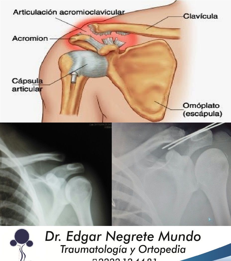 Edgar Negrete Mundo-6