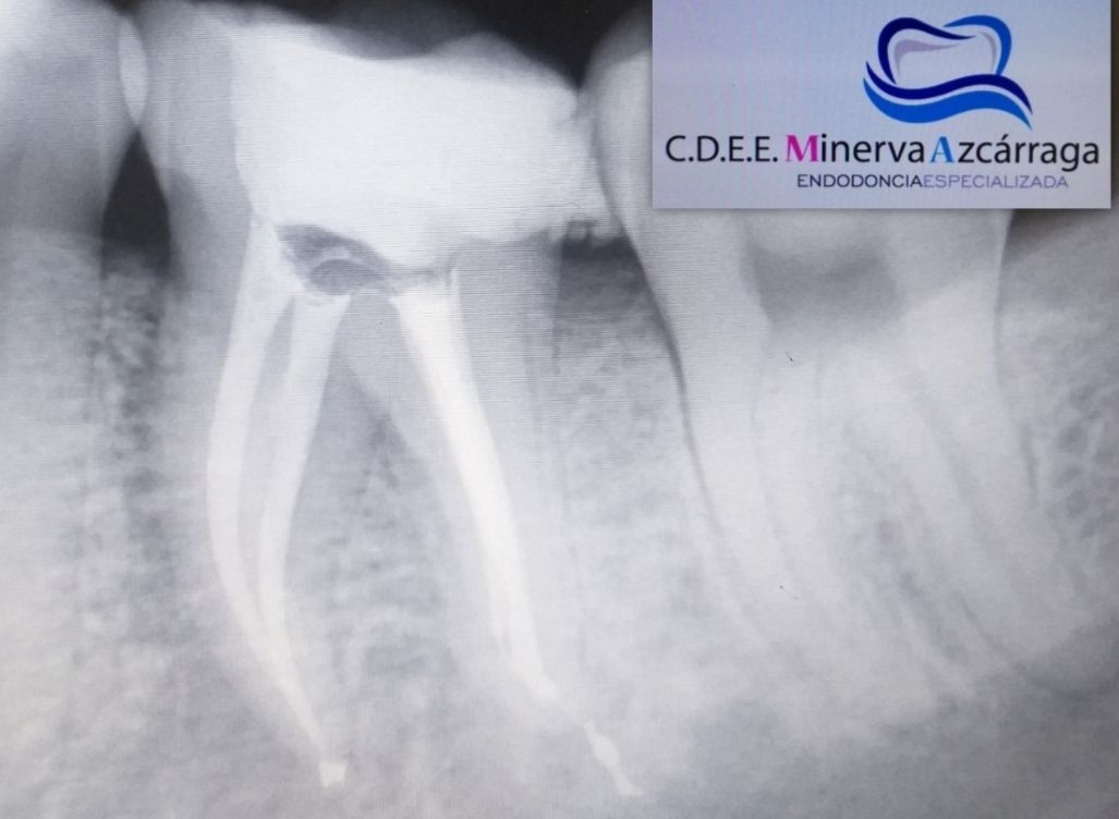 Minerva Azcarrága Aburto-2