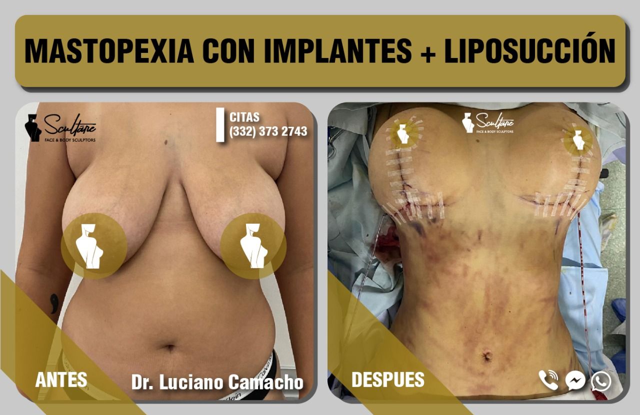 Luciano Alberto Camacho Alcalá-0