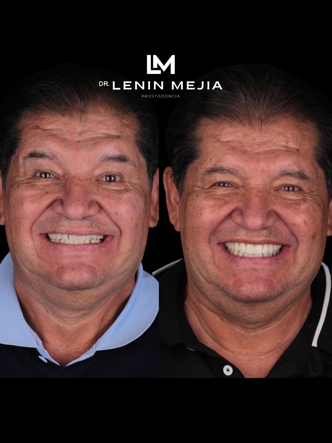Lenin Mejia-6