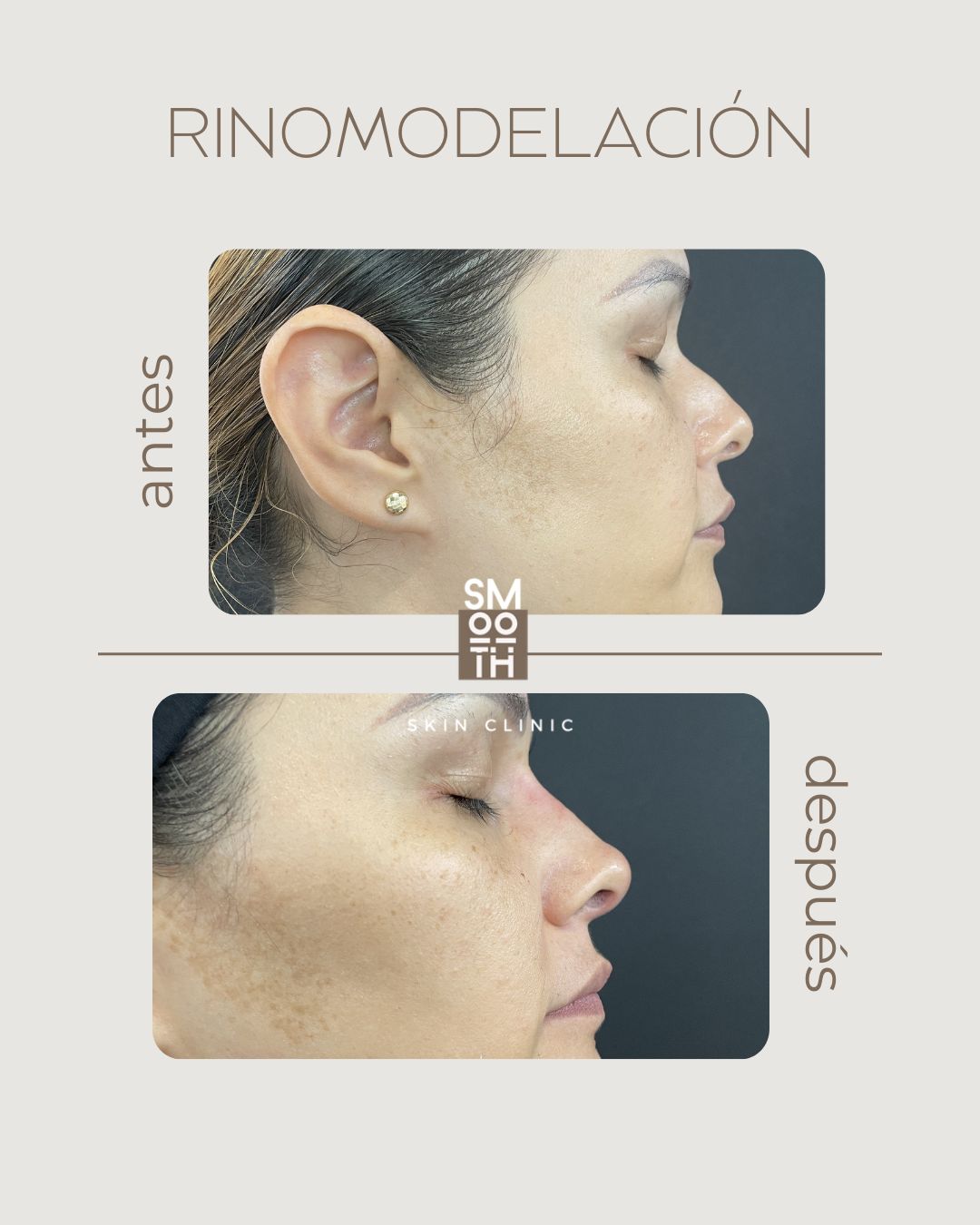 Samantha Martínez-86